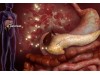 Type 1 Diabetes: What Are The Symptoms?